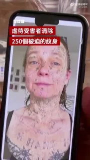 一位女士多年来遭受前伴侣的虐待，甚至在家中被迫进行纹身，直到她几乎全身都布满纹身，几乎没有任何一处皮肤幸免。